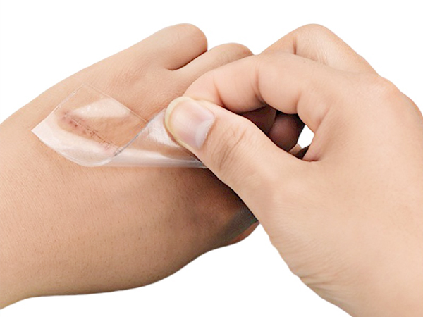 医用硅凝胶疤痕贴